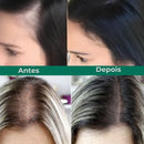 Paralisa a Queda e Acelera o Crescimento Capilar - Growth Hair